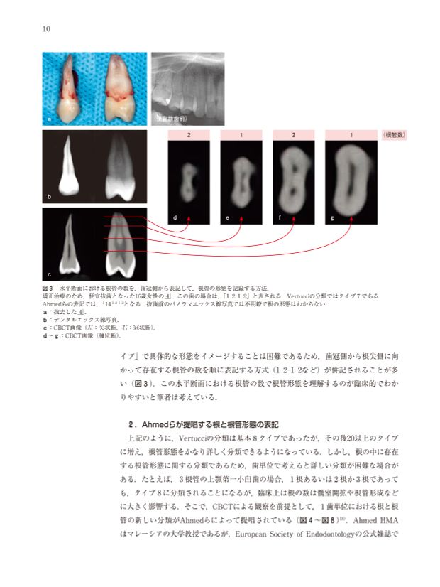 CT時代の臨床根管解剖