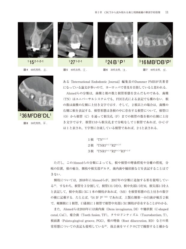 CT時代の臨床根管解剖