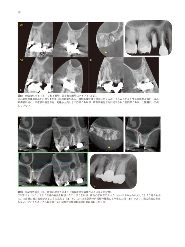 CT時代の臨床根管解剖