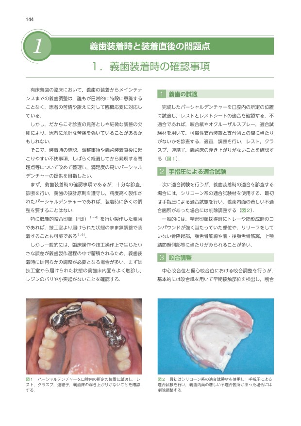 図解・咬合採得 81+9CXHoSXL._AC_UL210_SR210,