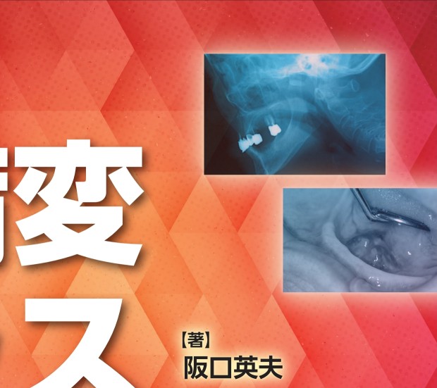 要介護高齢者の口腔病変アトラス