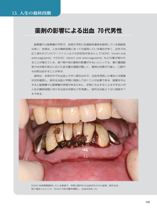 要介護高齢者の口腔病変アトラス 要介護高齢者の口腔病変アトラス