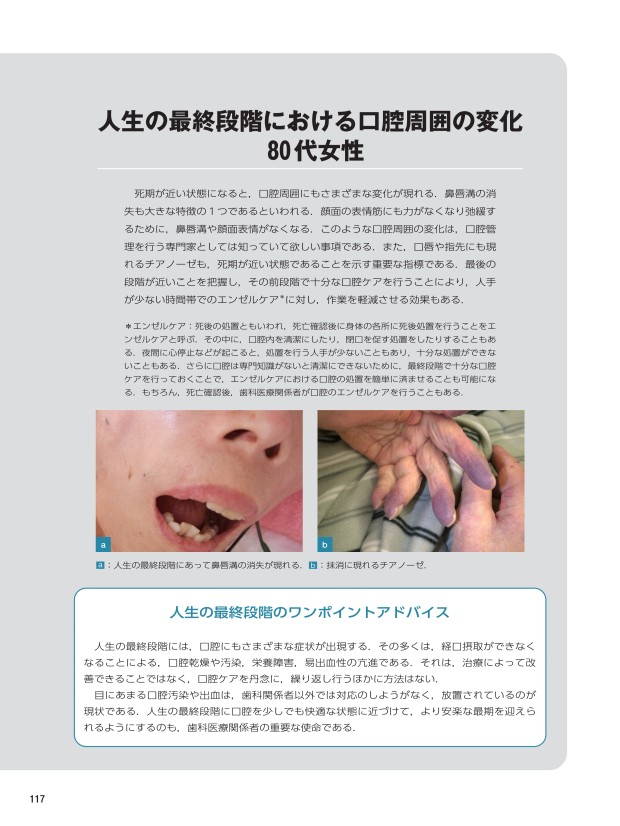 要介護高齢者の口腔病変アトラス 要介護高齢者の口腔病変アトラス