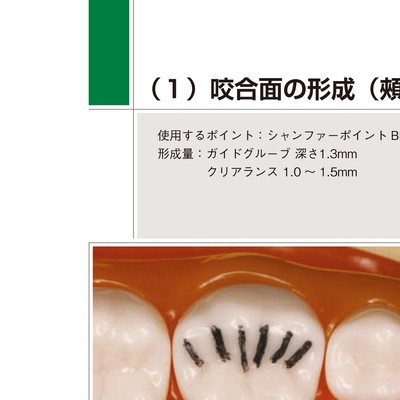支台歯形成と咬合の基本 支台歯形成と咬合の基本/医歯薬出版株式会社