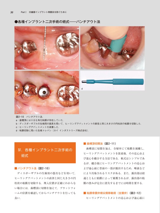 低侵襲ソフトティッシュマネジメント