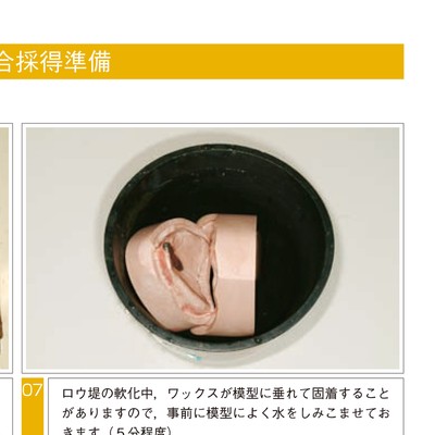 きちんと確実にできる全部床義歯の咬合採得