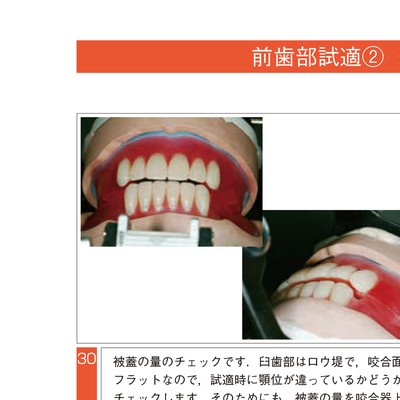 写真でマスターする きちんと確実にできる全部床義歯の試適・装着 51wUIjyOkHL.jpg